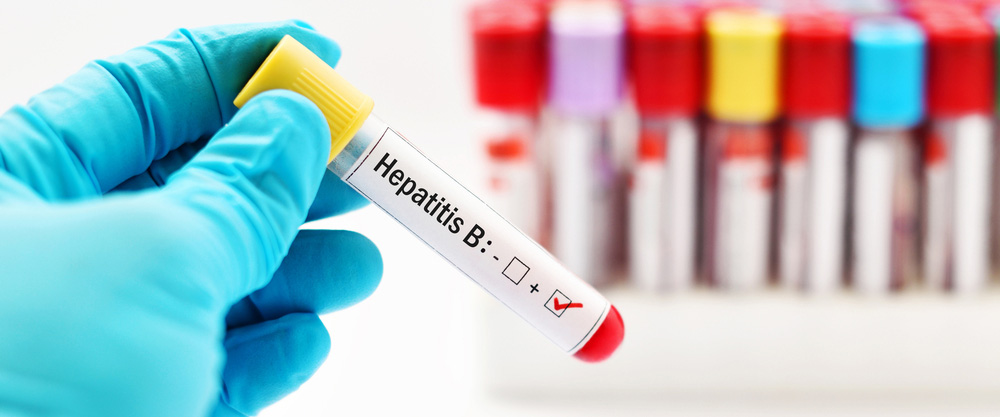 Apakah Hepatitis B? Apakah gejala dan kaedah rawatan?